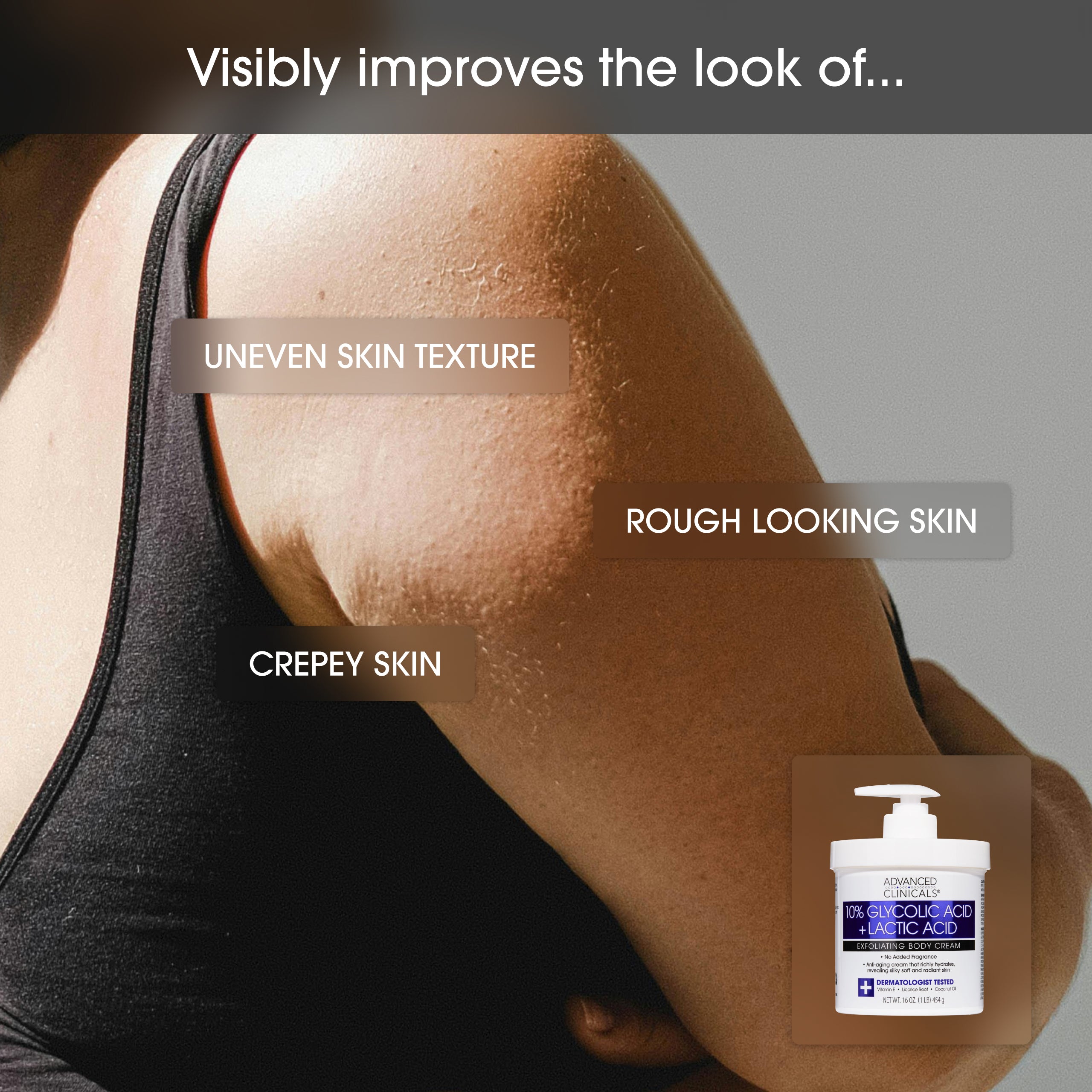 Advanced Clinicals 10% Glycolic Körpercreme mit Milchsäure