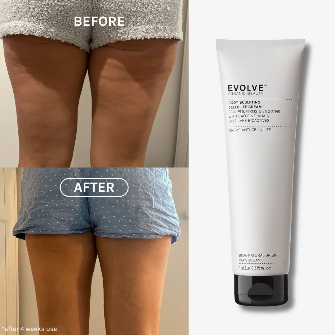Evolve Body Sculpting Cellulite Creme Straffend Koffein