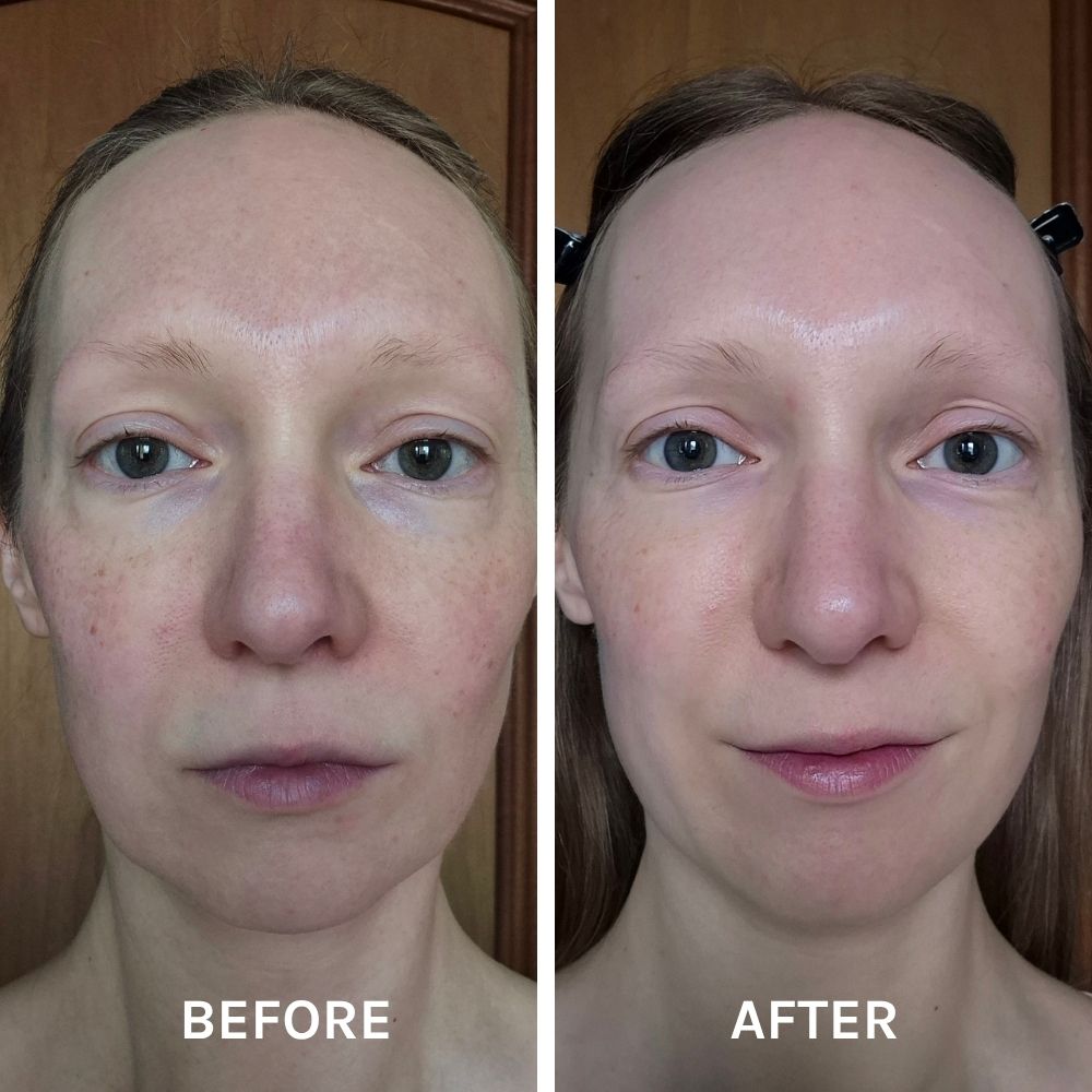 Evolve Organic Face Serums EGF + Collagen Serum trockene Haut