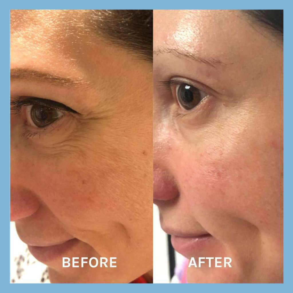 Evolve Age Defying Lifting Serum Gesichtsserum Reisegröße Falten