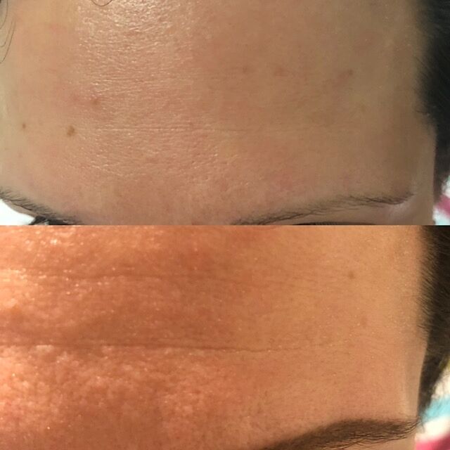 Evolve Age Defying Lifting Serum Gesichtsserum Reisegröße Falten